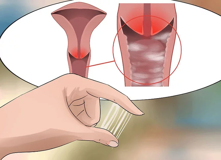 Nguyên Nhân Vùng Kín Có Mùi Khó Chịu? - Thạc sĩ. Bác sĩ Hồ Quang Nhật bệnh viện Từ Dũ